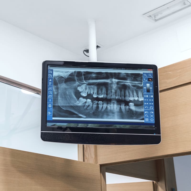 Dental Technology, Kanata Dentist